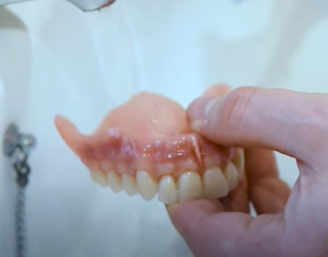 How long do dentures last?